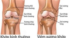  Tác dụng của đông trùng hạ thảo với xương khớp 